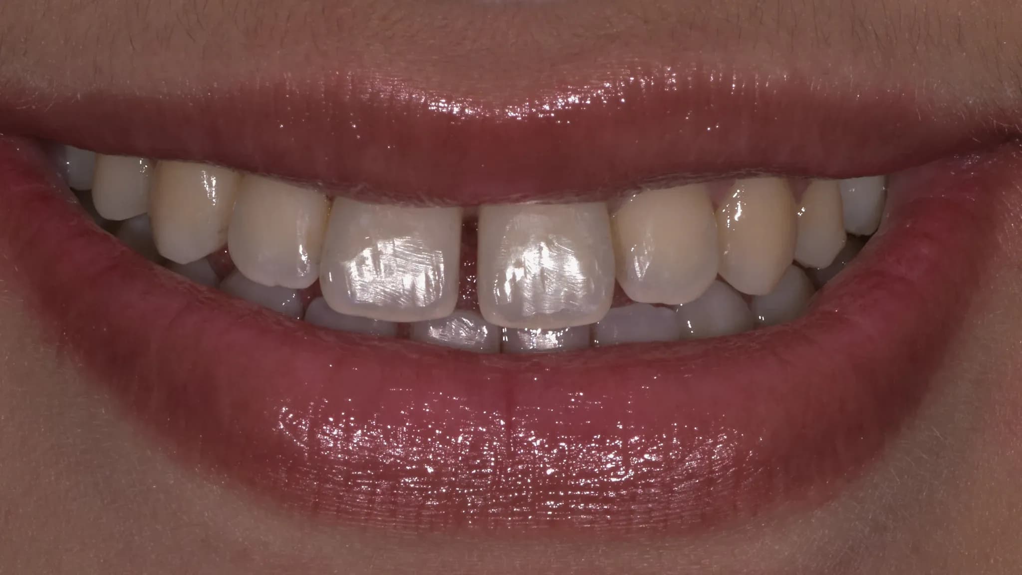 spectrum gallery 04 orthodontics earlier