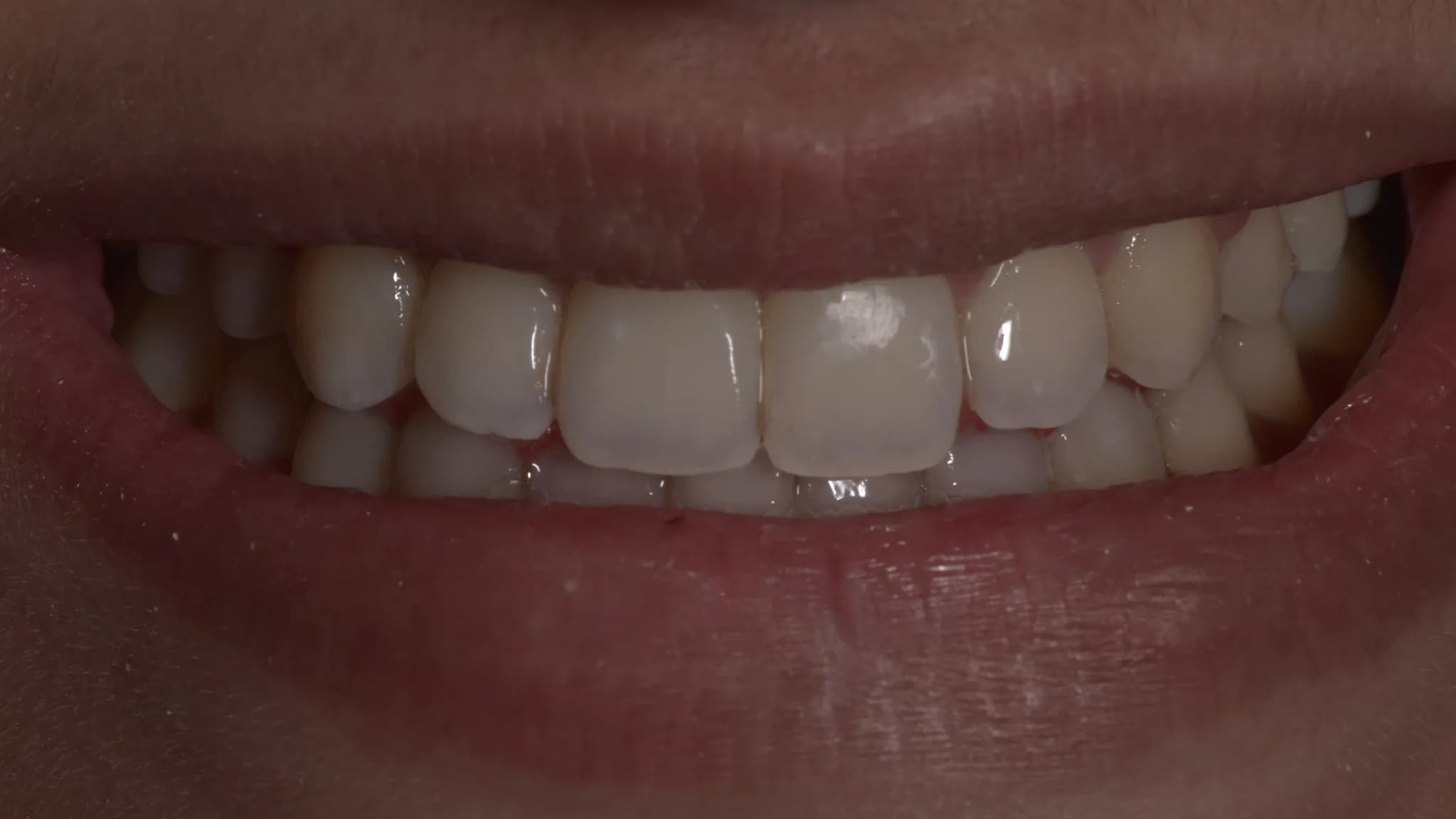 spectrum gallery 04 orthodontics later