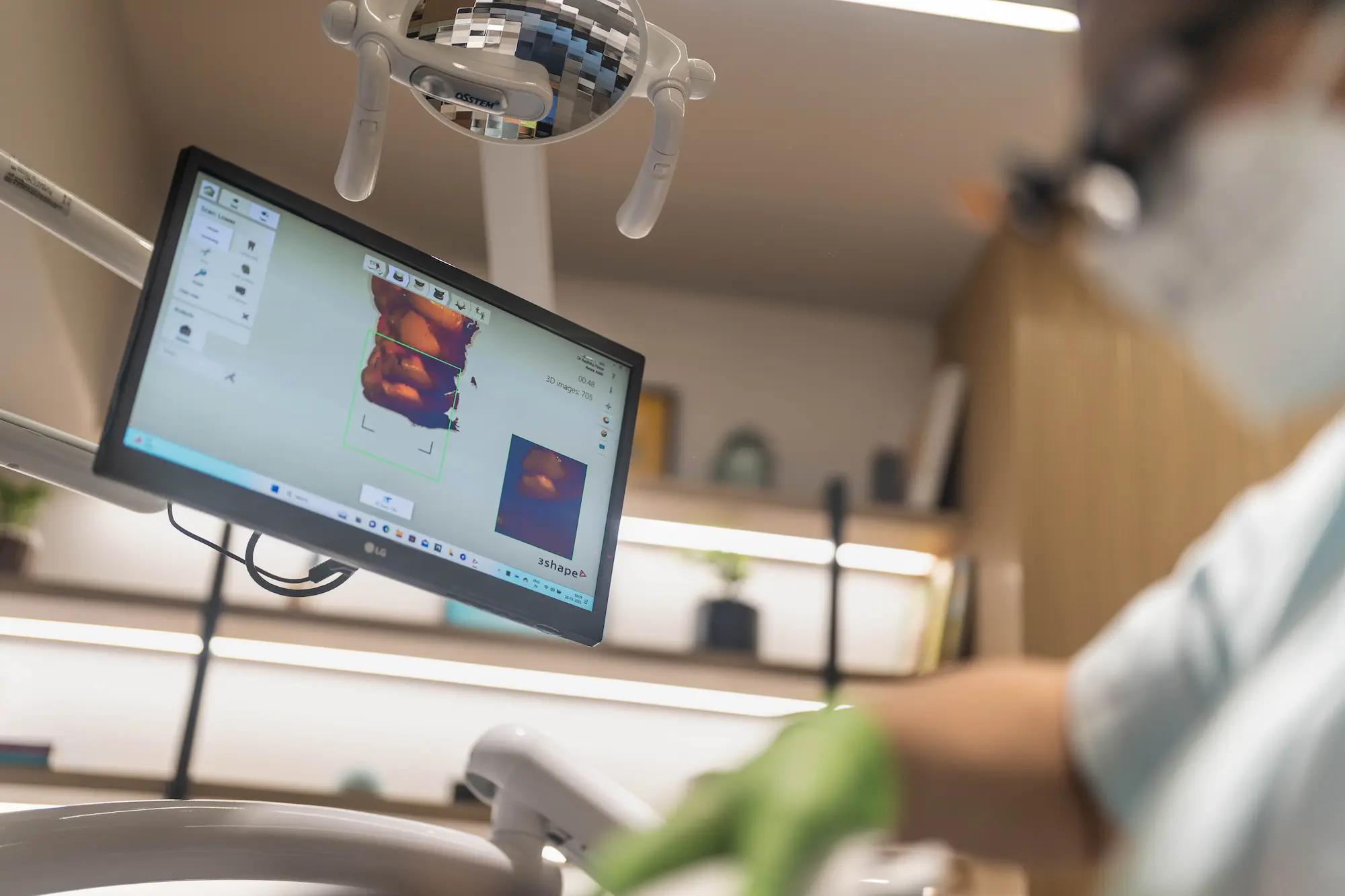 3D-Scanning Teeth to create one day crowns and mouthguard digital Dentistry